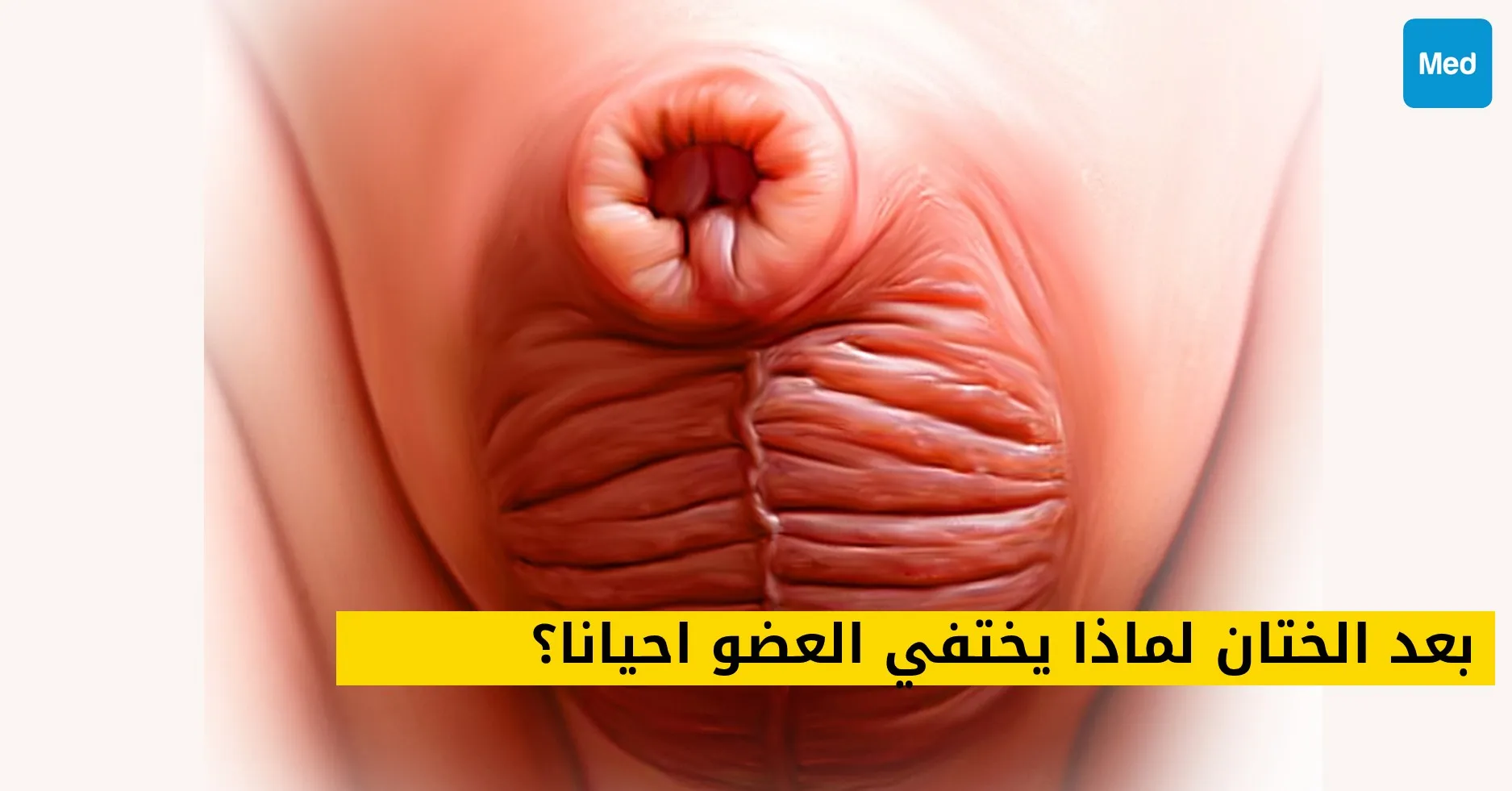 بعد الختان لماذا يختفي العضو احيانا؟